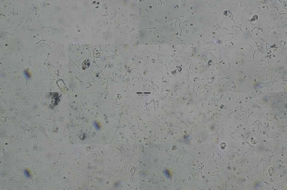 Fig 4 - ?Spirochaete bacteria?