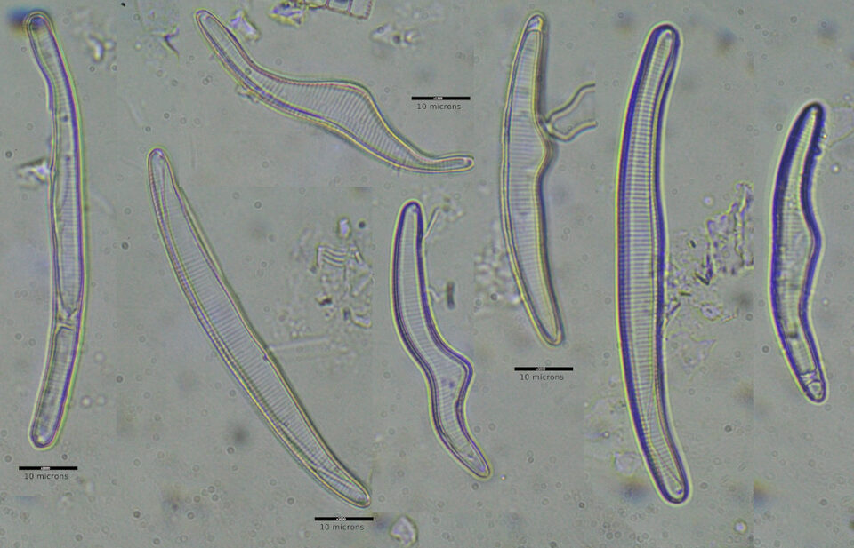 Fig 5 - Various Teratological forms of Eunotia