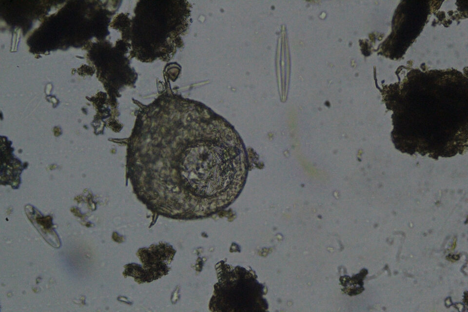 Testate amoebae test from the anoxic bottom sediment of the lake