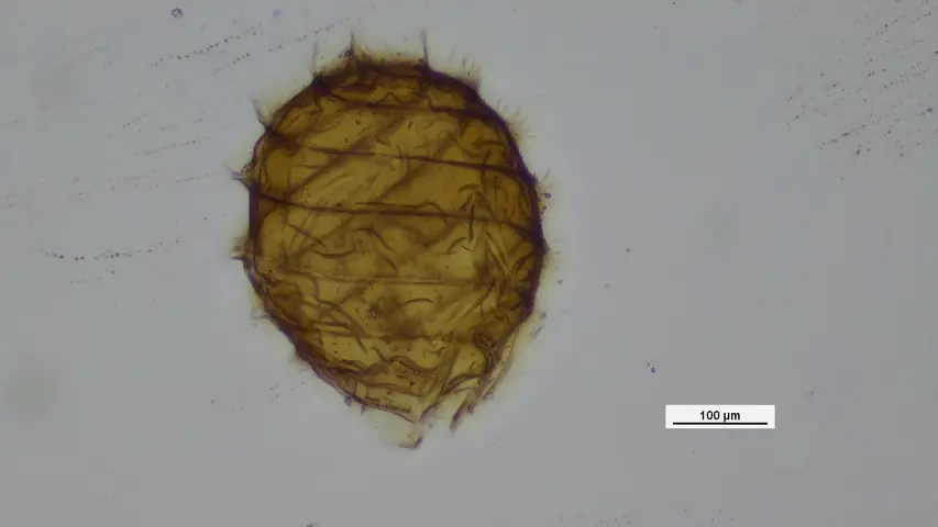 An oospore of the freshwater plant-like alga Chara - Stonewort